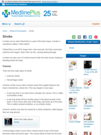 Medical Encyclopedia: Stroke